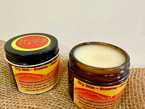 Seriously Dry Skin Salve, Eczema, Scars, Stretch Marks, Cracked, Damaged Sensitive Skin, All Natural Vegan Cream