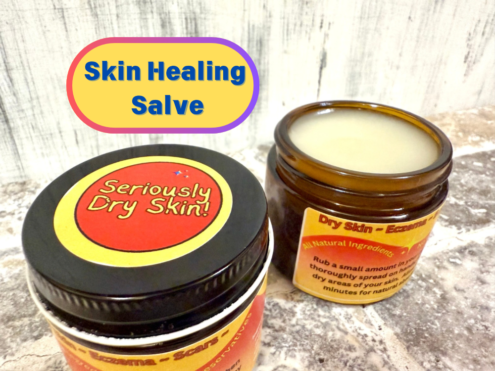 Seriously dry skin moisturizer balm, 4oz amber glass jar