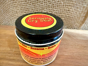 Seriously Dry Skin Salve, Eczema, Scars, Stretch Marks, Cracked, Damaged Sensitive Skin, All Natural Vegan Cream