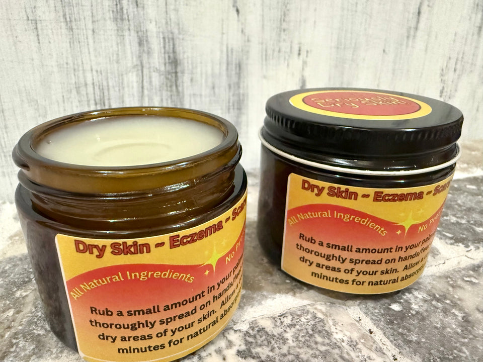 Seriously Dry Skin Salve, Eczema, Scars, Stretch Marks, Cracked, Damaged Sensitive Skin, All Natural Vegan Cream