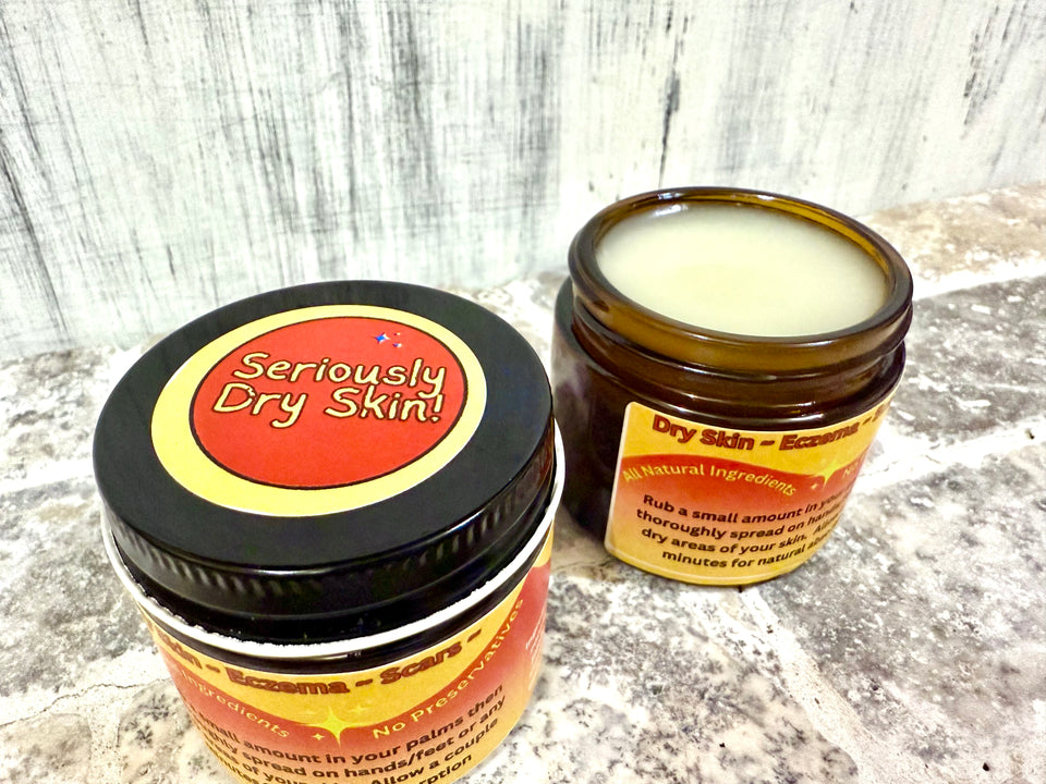 Seriously Dry Skin Salve, Eczema, Scars, Stretch Marks, Cracked, Damaged Sensitive Skin, All Natural Vegan Cream